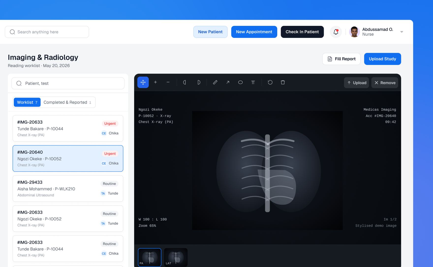 Imaging and Radiology worklist with a chest X-ray open in the viewer